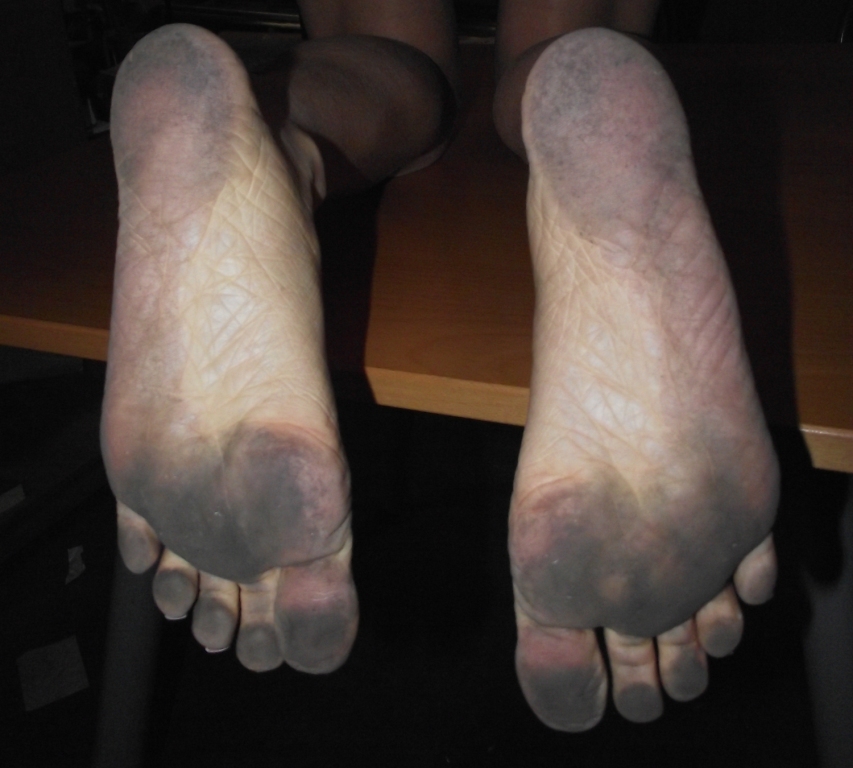 Michelle Anderson Feet