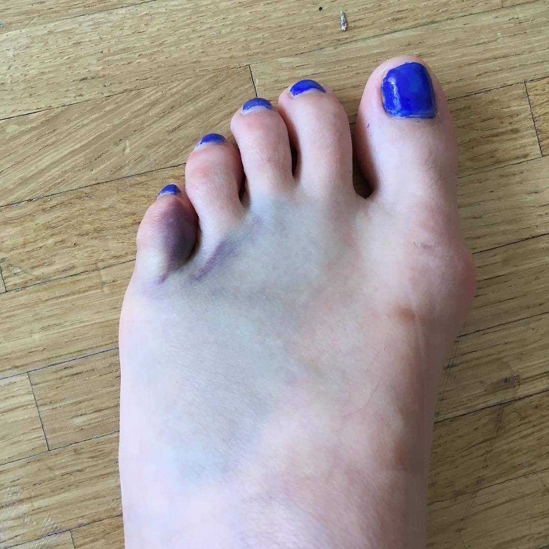 Olivia Csiky Trnka Feet