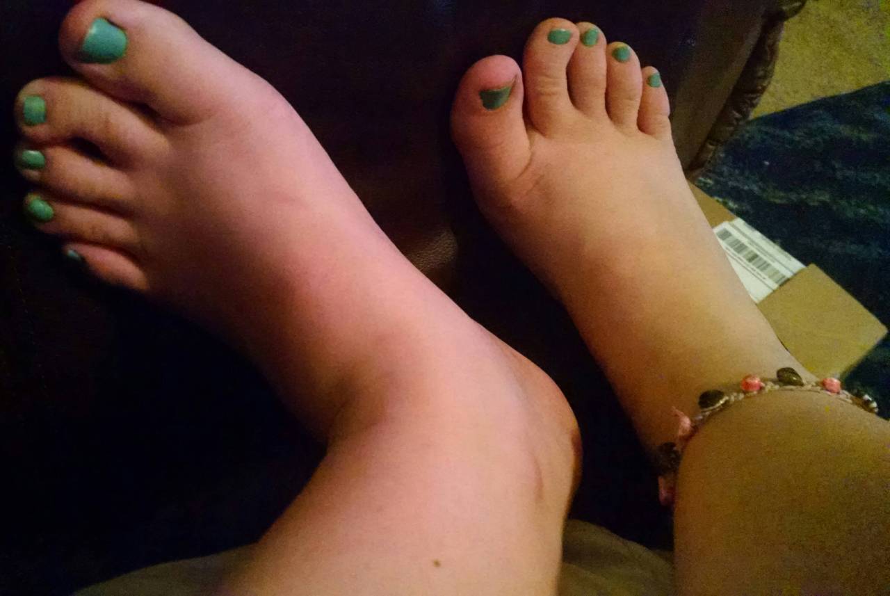 Blue Toes And New Anklet 3 Feet Toes Footfetis