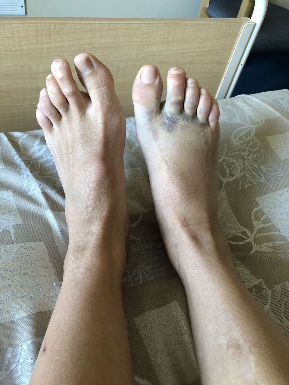 Caitlin Foord Feet