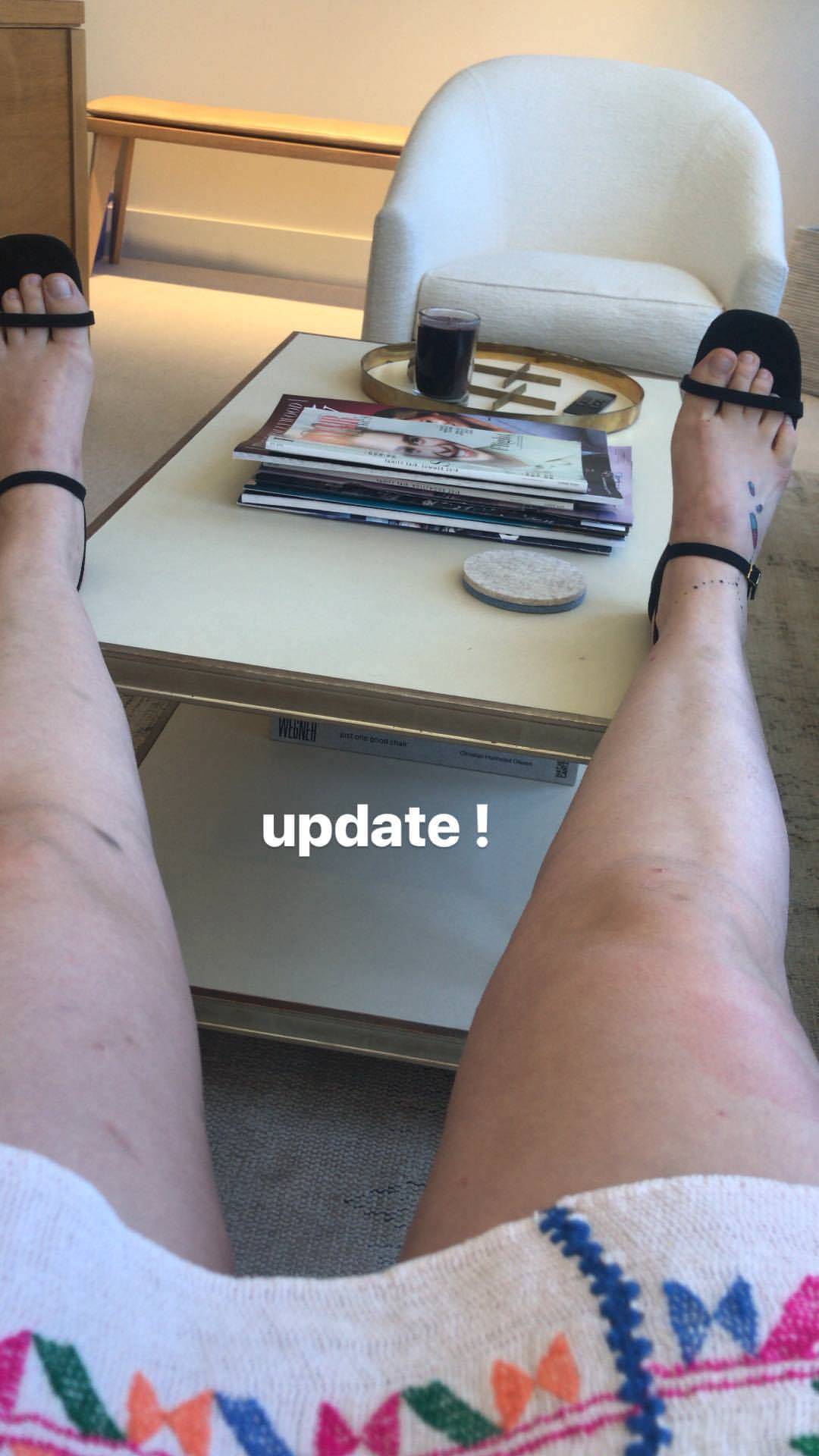Lena Dunham Feet Toes Footfetis