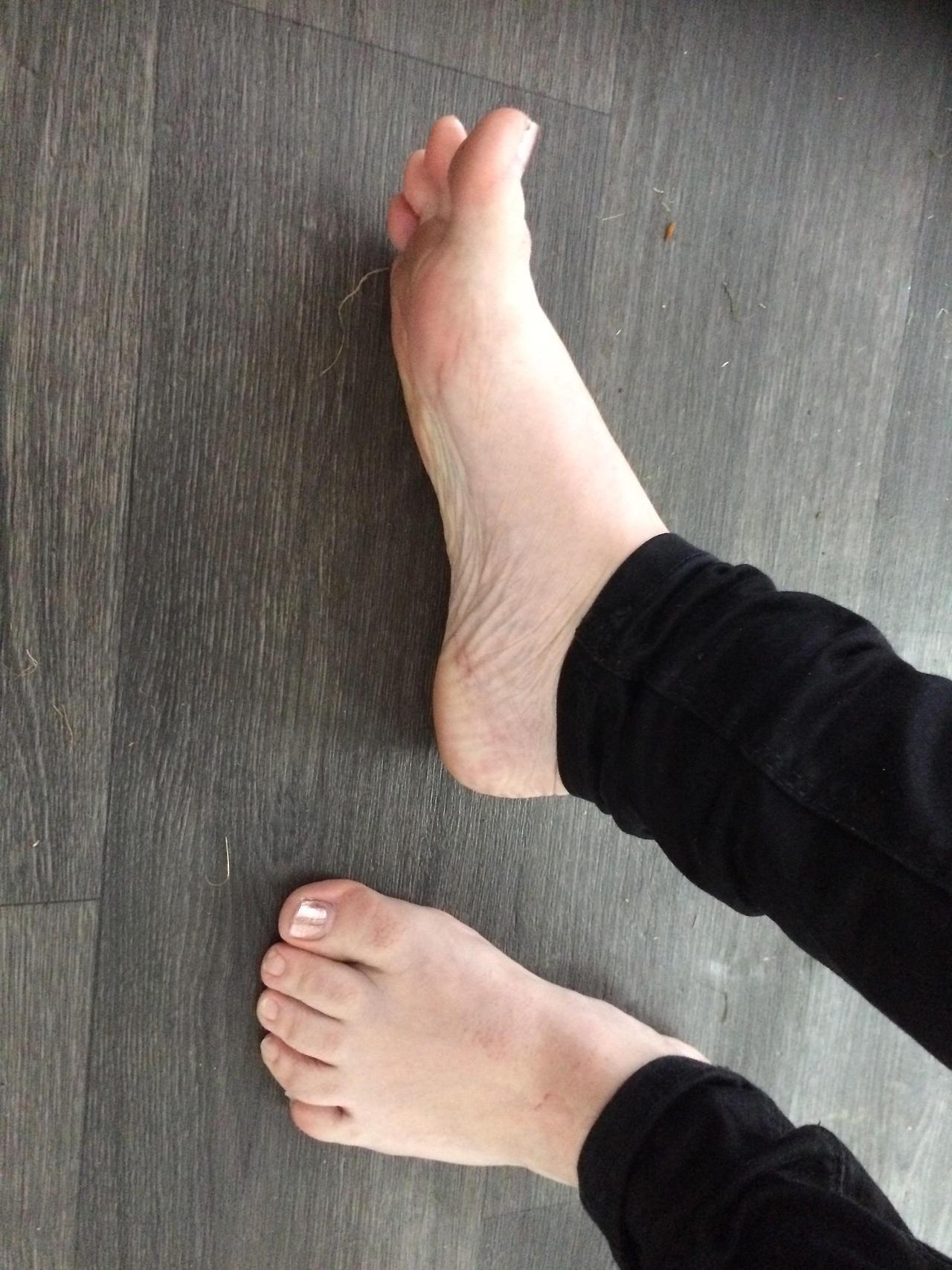 Requested Pic I Think My Toes Are Weird Feet Toes Footfetis