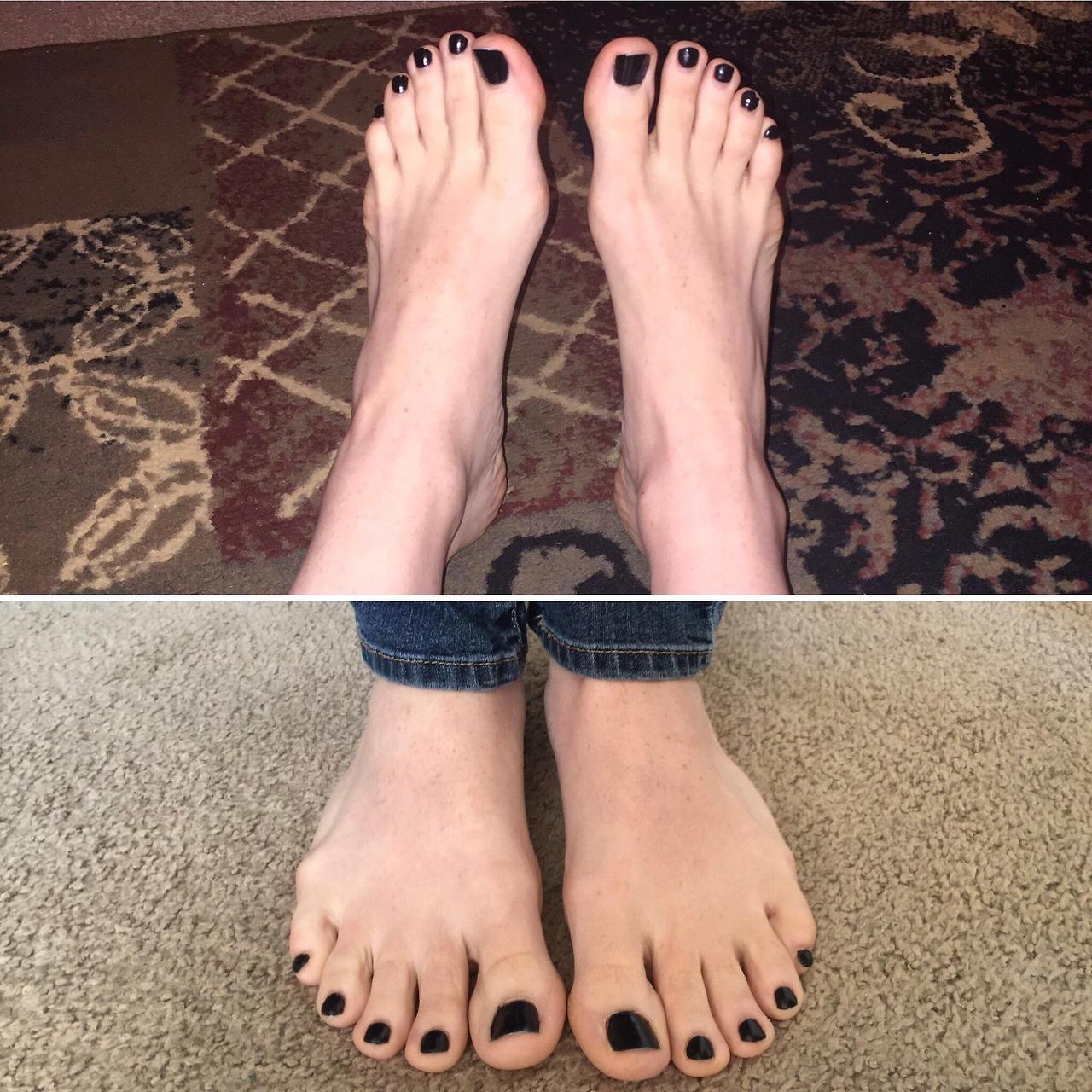 This Is My First Post Curious What You All Think Feet Toes Footfetis