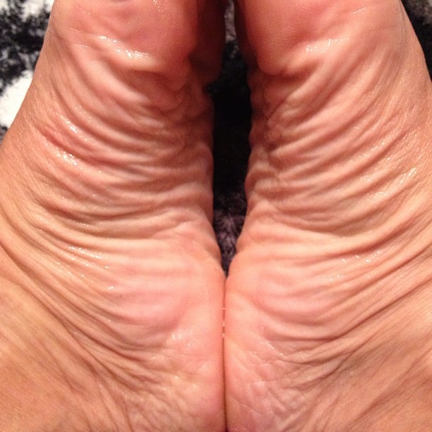 Up Close Personal With The Wrinkles Fee