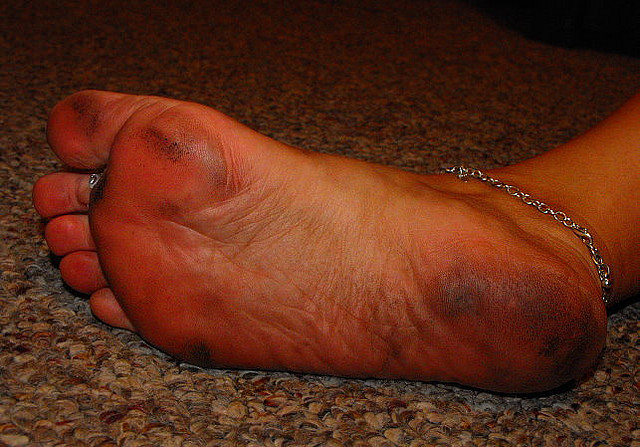 Via Dirty Feet After All Day At A Cookou