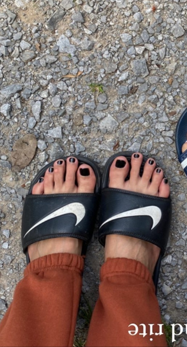 Xian Mikol Feet