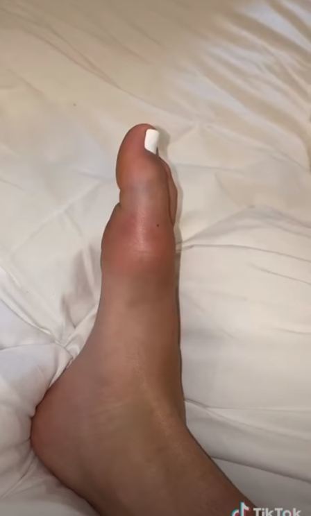 Dixie Damelio Feet