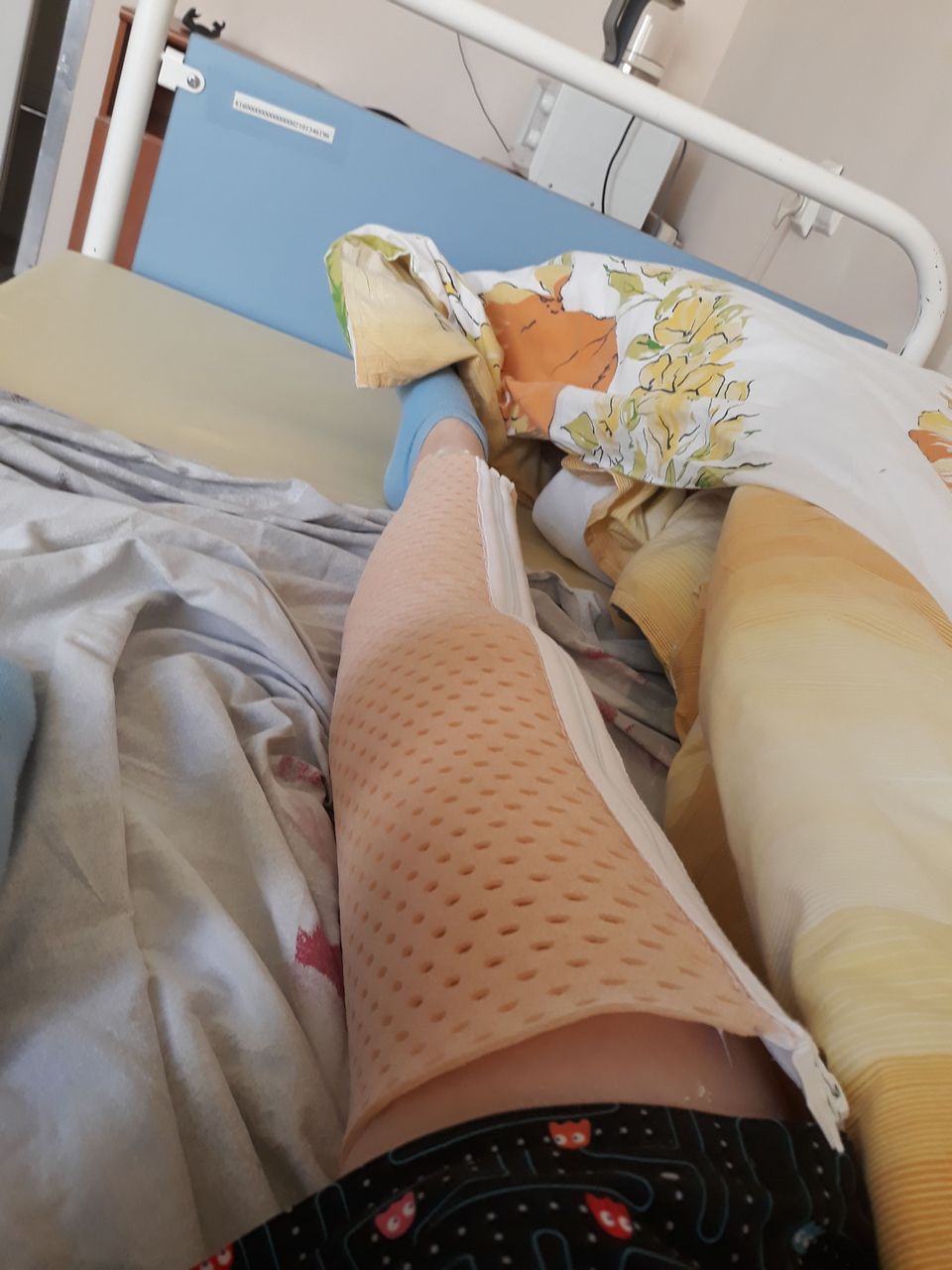 Golden Crush Story Of Broken Leg