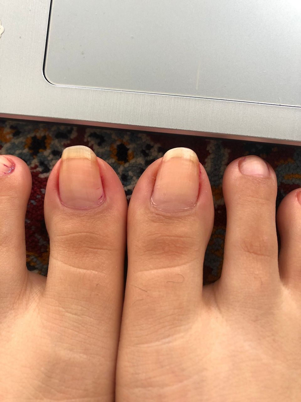 Miki Feet Nails