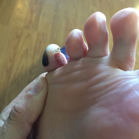 Carrie Swidecki Feet