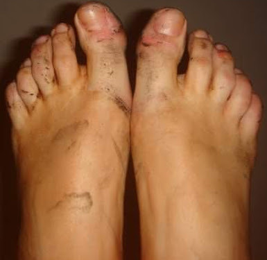 Laura Woods Feet
