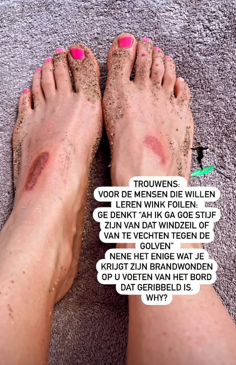 Lynn Van Den Broeck Feet
