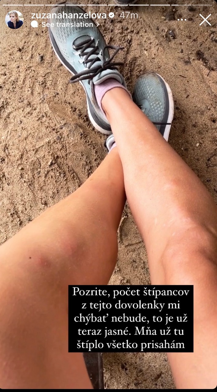 Zuzana Kovacic Hanzelova Feet