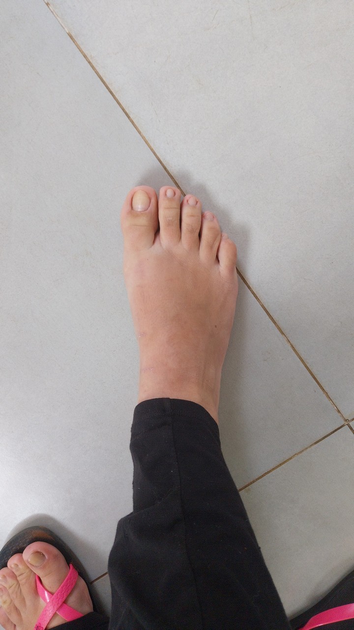 Feet Wikifeet