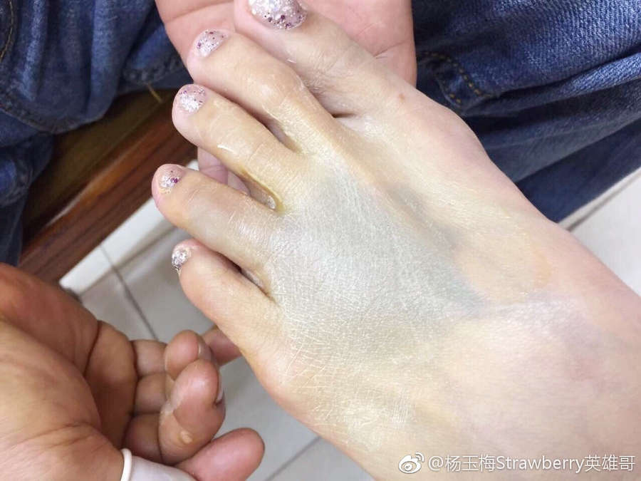 Yuk Mui Yeung Feet