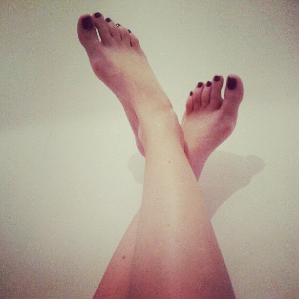 Edita Misiric Feet