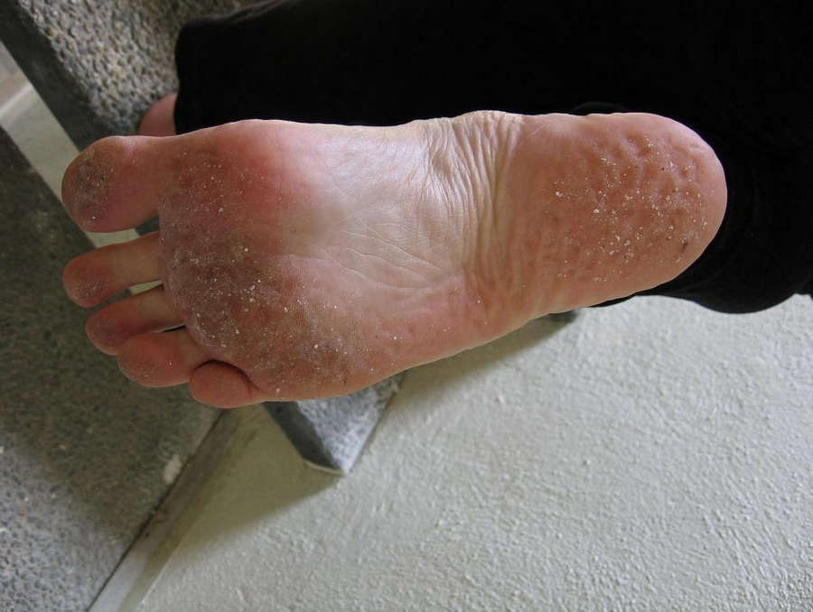 Kira Eggers Feet
