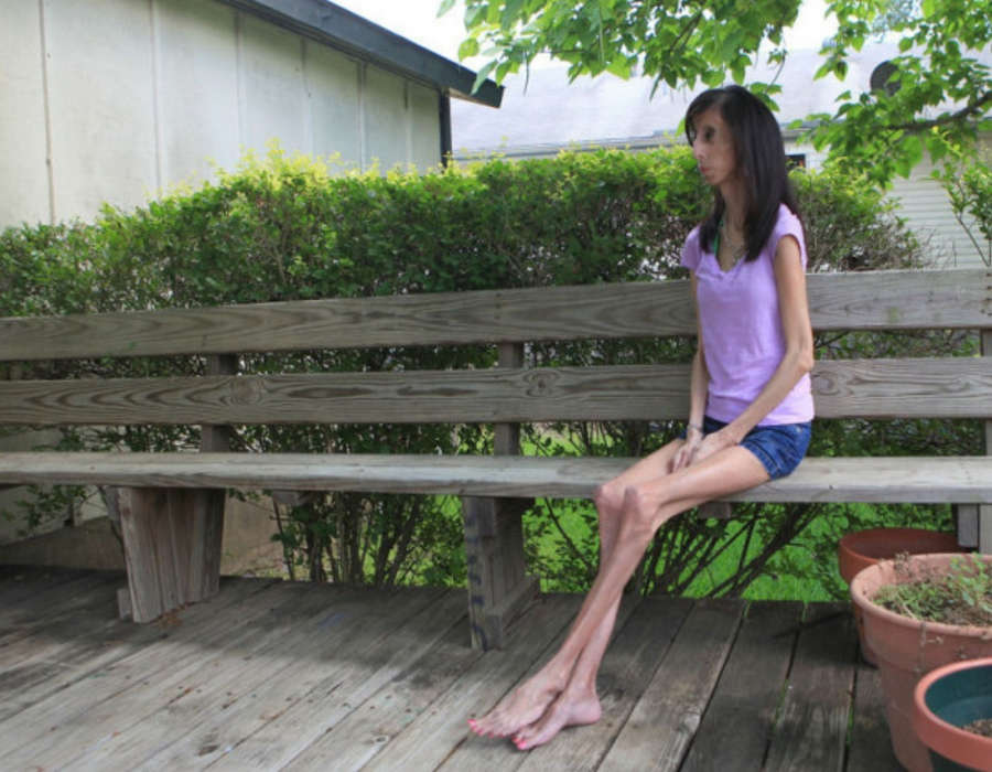 Lizzie Velasquez Feet