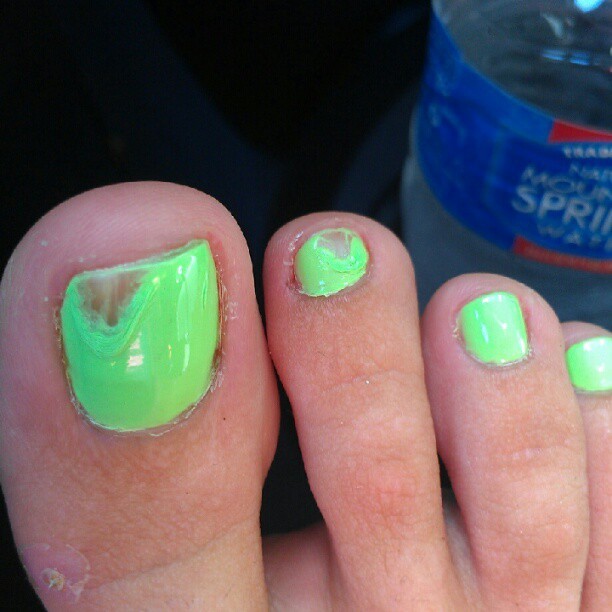 Jennifer Durst Feet