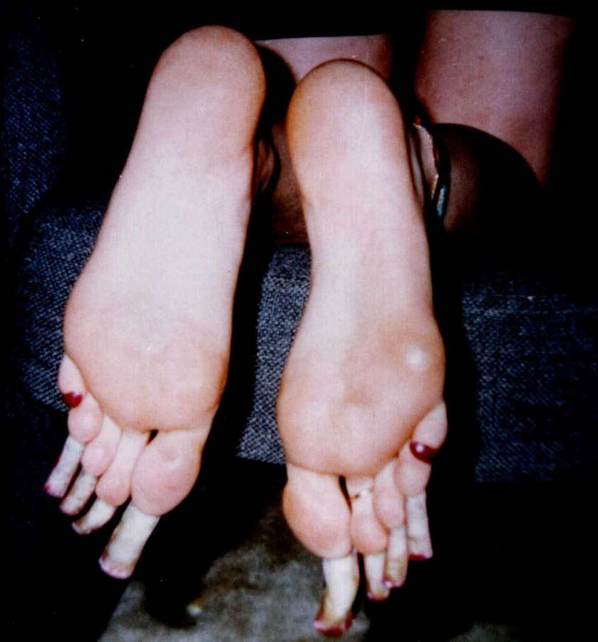 Kathy Hayes Feet