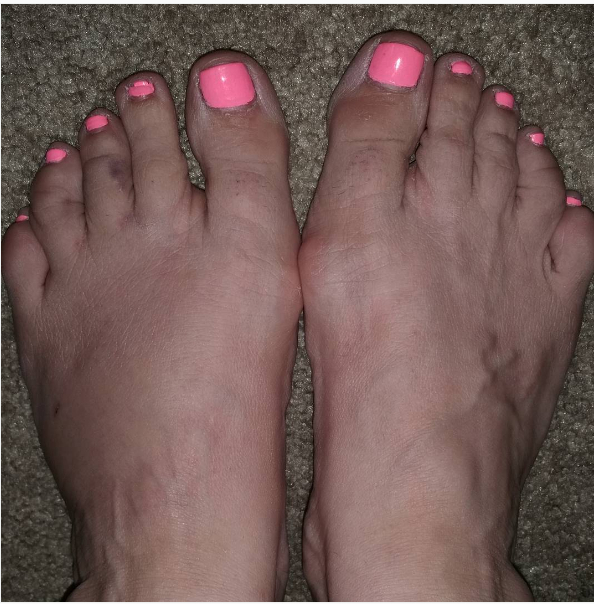 Marilyn Ghigliotti Feet