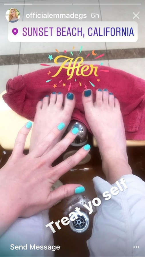 Emma Degerstedt Feet