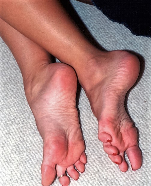 Andrea Neal Feet