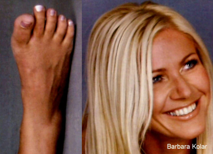 Barbara Kolar Feet
