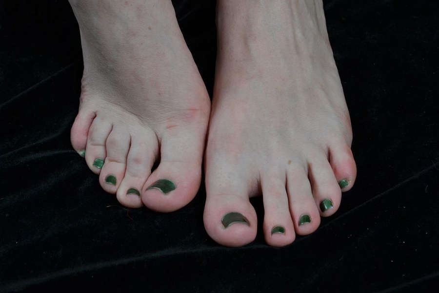 Quinn Helix Feet