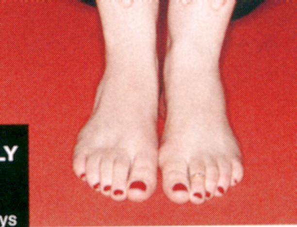 Monica Lewinsky Feet