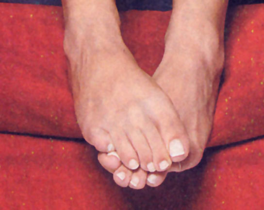 Kalomoira Sarantis Feet