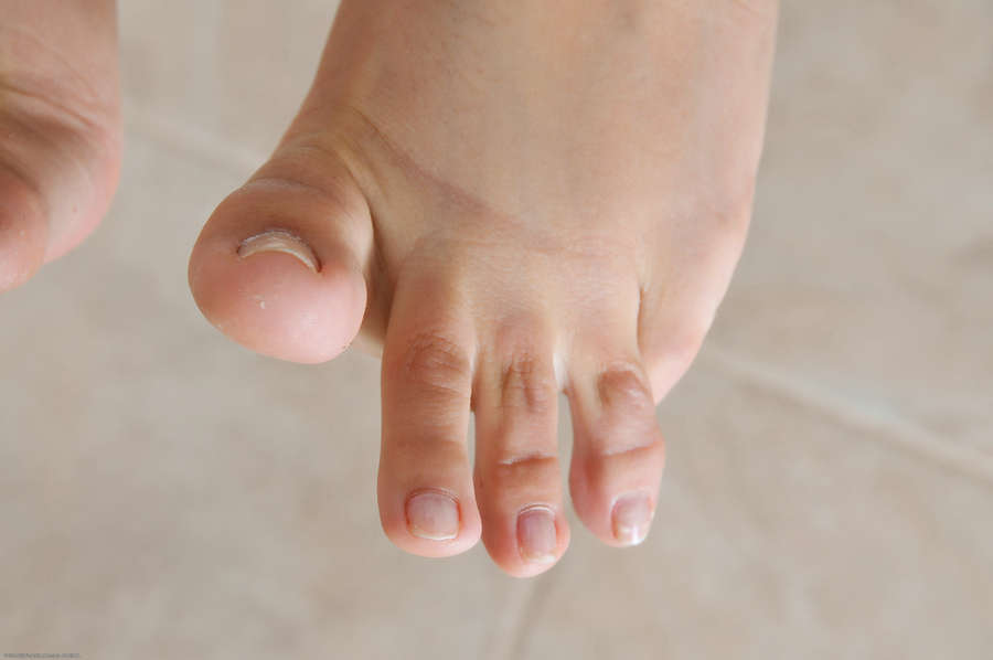 Miloslava Kaprova Feet