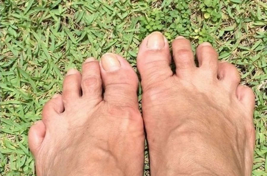 Fafa De Belem Feet