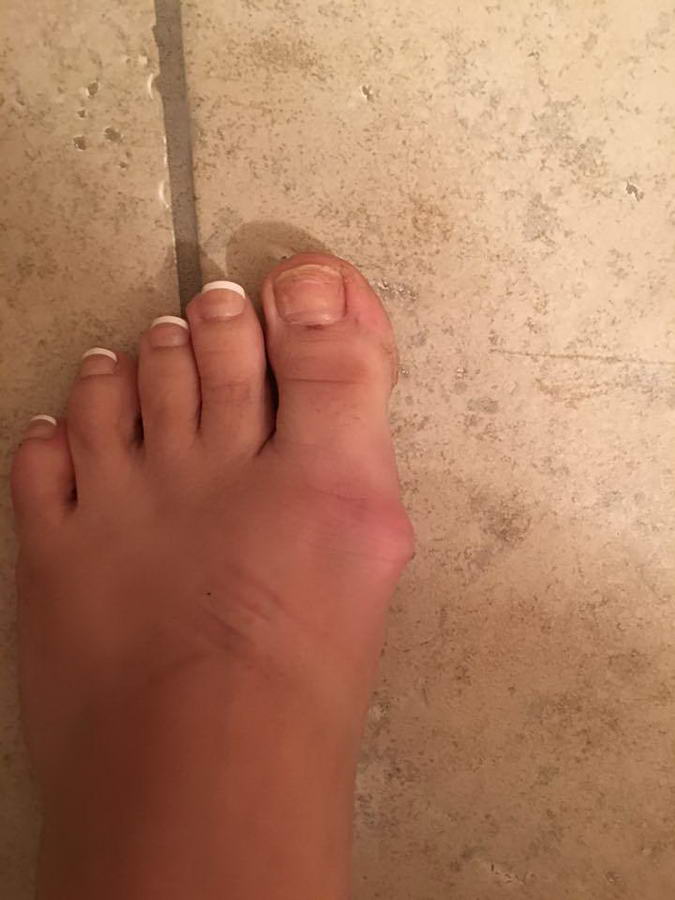 Gabrielle Giffords Feet