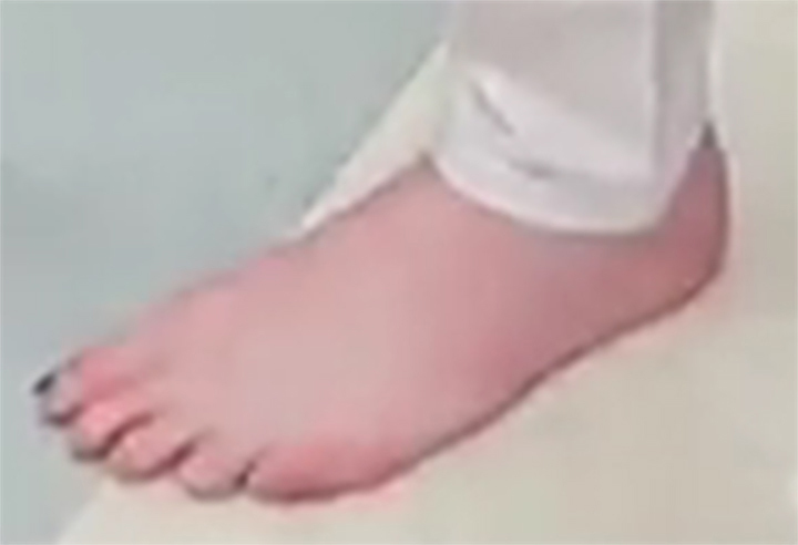 Eugenia Cooney Feet