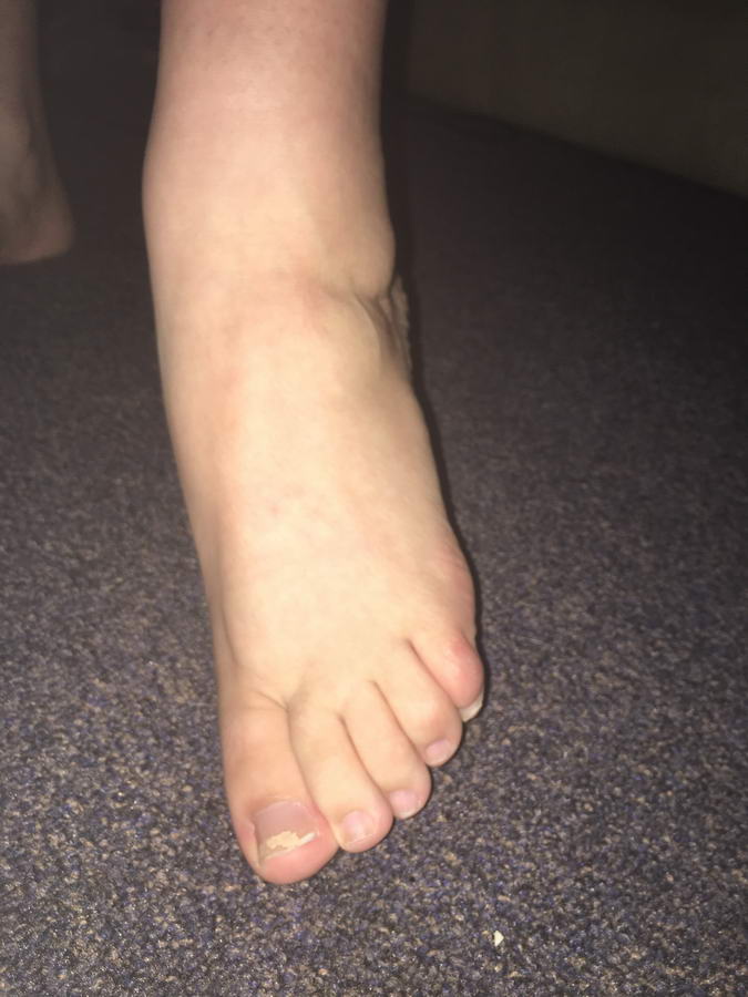 Dakota Lee Feet