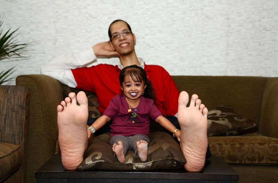 Jyoti Amge Feet