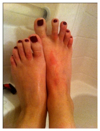 Cherry Torn Feet