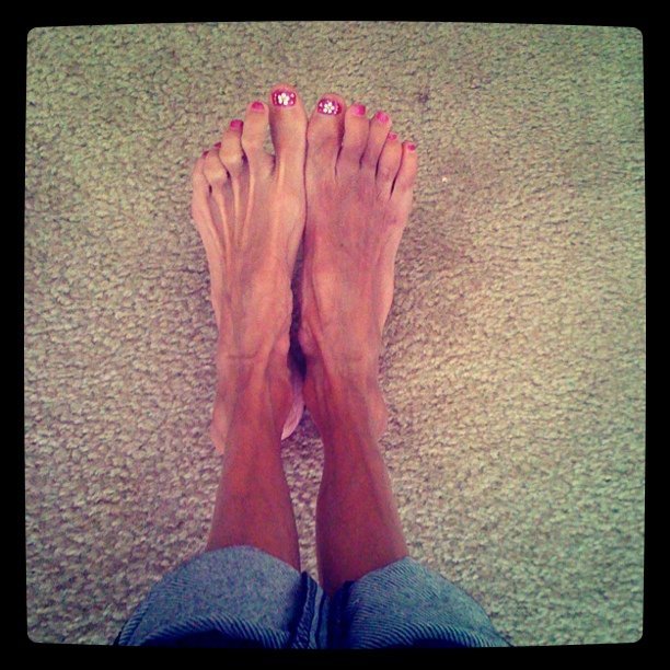 Lizzie Velasquez Feet