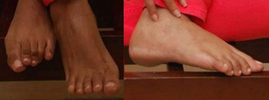 Yureni Noshika Feet