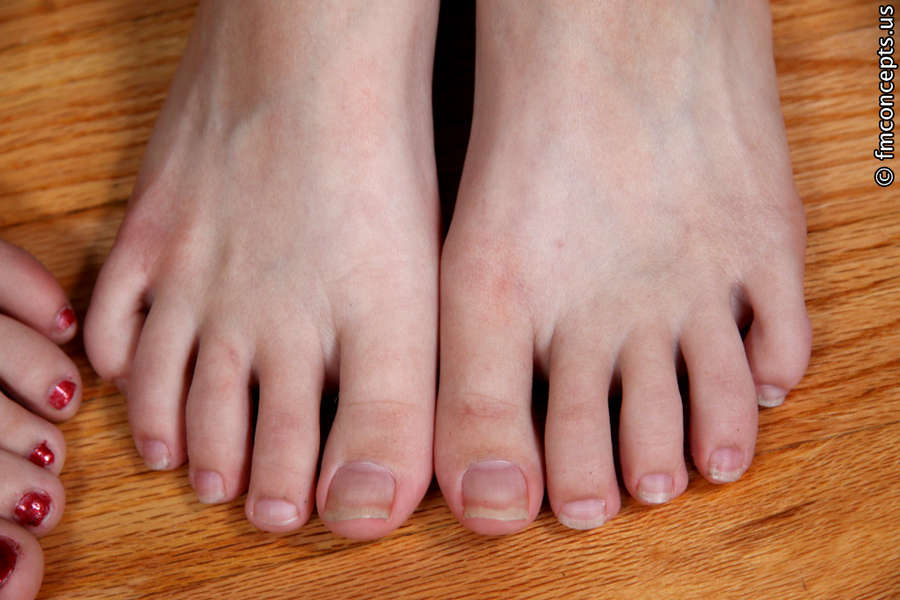Akara Allison Feet