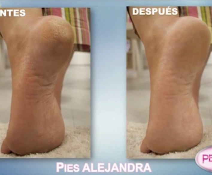 Alejandra Navas Feet